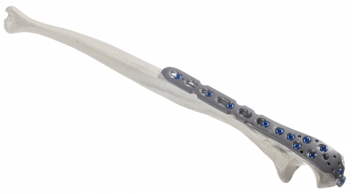 Olecranon_AF-Medical_161-1 Olecranon_AF-Medical_161-1