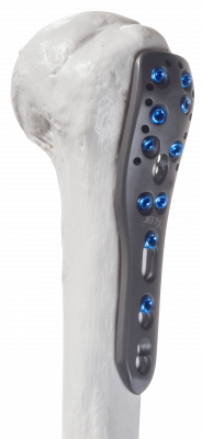 Humerus-proximal_AF-Medical_147-1