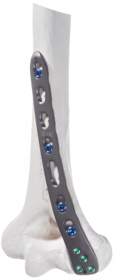 Humerus-distal-dorsolateral_AF-Medical_146-1_cut Humerus-distal-dorsolateral_AF-Medical_146-1_cut