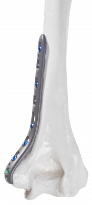 Humerus-distal-medial_AF-Medical_158 Humerus-distal-medial_AF-Medical_158