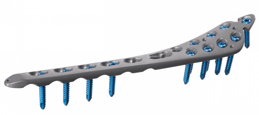 Tibia-distal-tab_AF-Medical_027-1