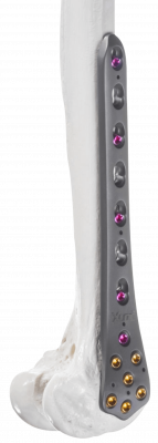 Femur-distal_AF-Medical_157-1-2000px